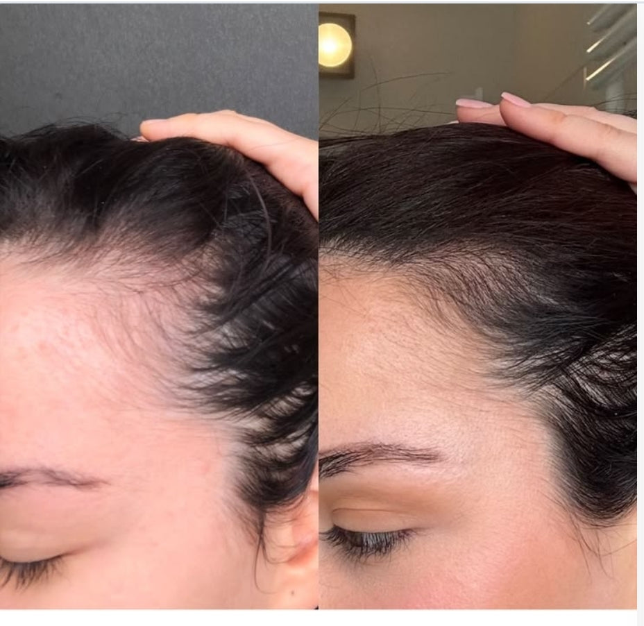 Le Rituel Renaissance – Cheveux Forts & Croissance Stimulée