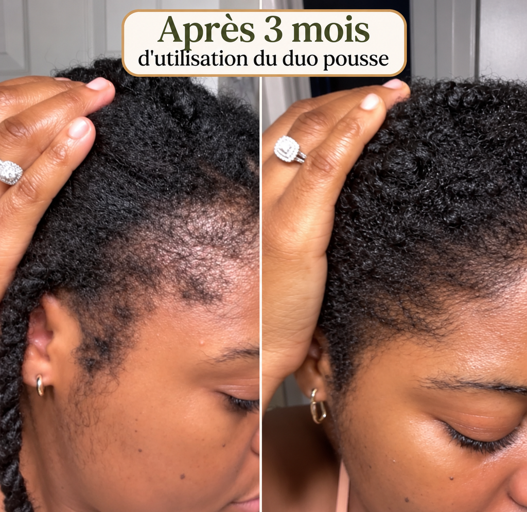 Le Rituel Renaissance – Cheveux Forts & Croissance Stimulée